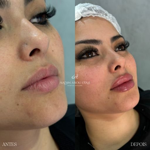 Labios (3)