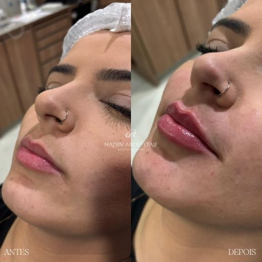 Labios (4)