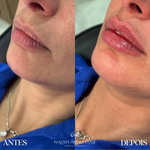 Labial - Nadin Abou